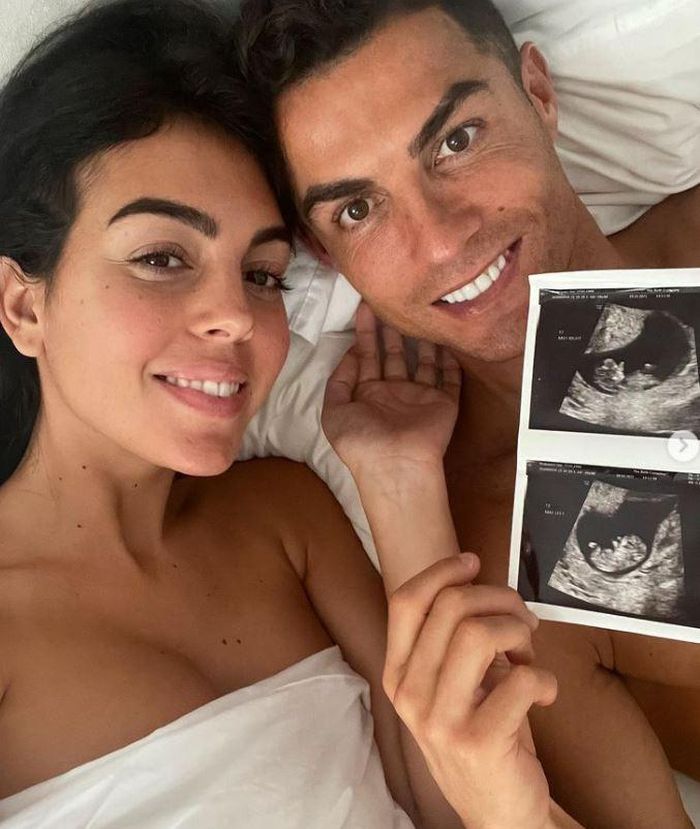Ronaldo khoe hình siêu âm của bạn gái Rodriguez.