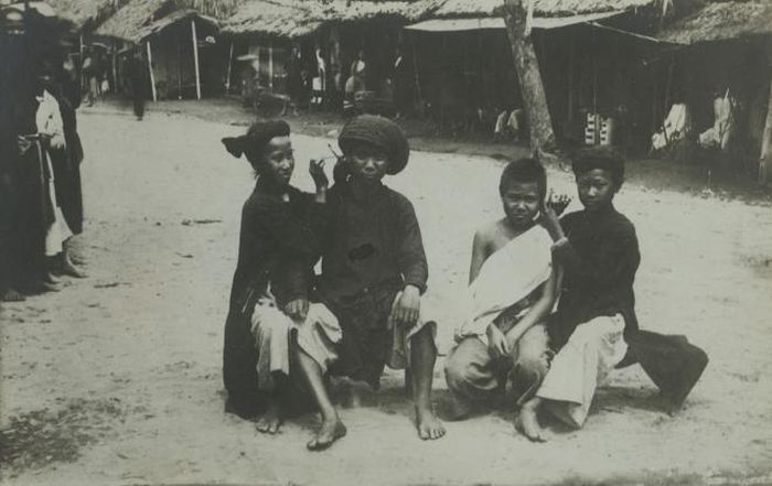 Lấy ráy tai ngoài đường