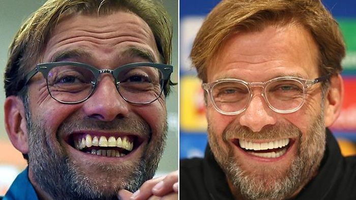 Jurgen Klopp đẹp rạng ngời với bộ răng mới