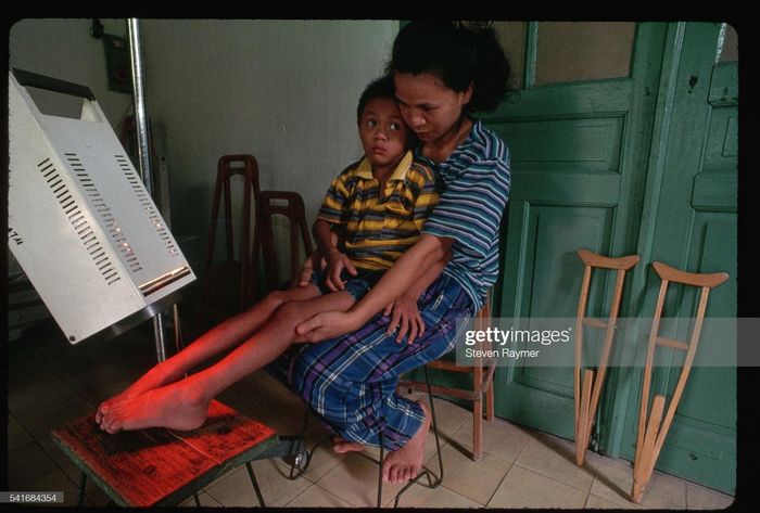 Một cậu bé ngồi trong lòng mẹ khi chiếu tia hồng ngoại vào chân tại Bệnh viện Bạch Mai. Em đang được trị liệu để hồi phục sau khi mắc bệnh Viêm não Nhật Bản B.