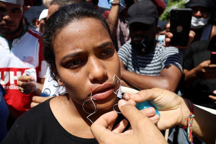 Người phụ nữ khâu miệng để gây sức ép chính quyền Mexico. Ảnh: Reuters / Jose Torres.