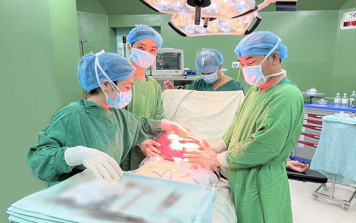 Khối u nặng 4,5 kg được tách bóc thành công ra khỏi ổ bụng bệnh nhân.