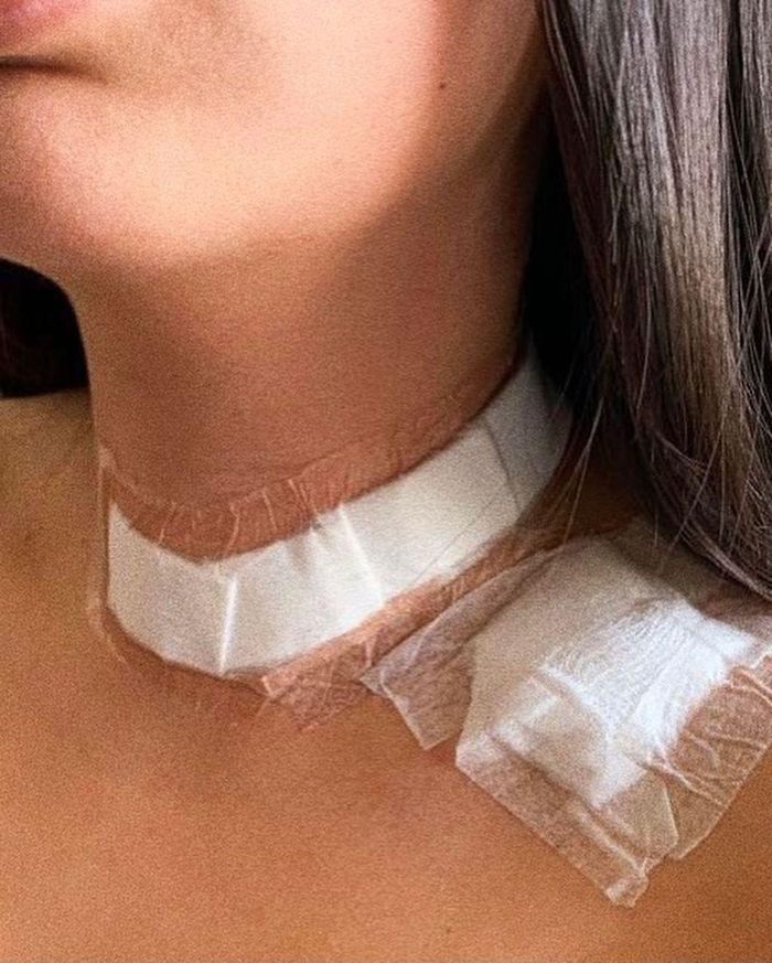 Gabriella phát hiện và điều trị kịp thời bệnh ung thư nhờ tiết học ở trường. 
