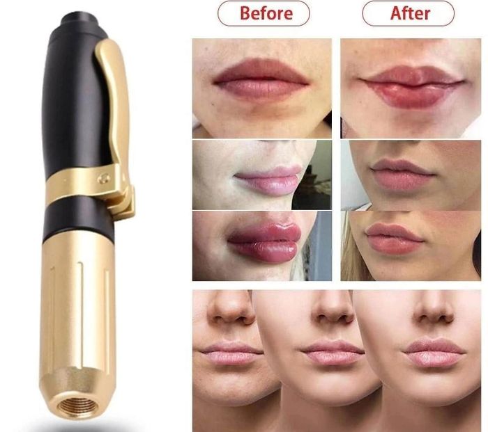 Bút hyaluron được quảng cáo dễ sử dụng, không gây đau. Ảnh: DHG.
