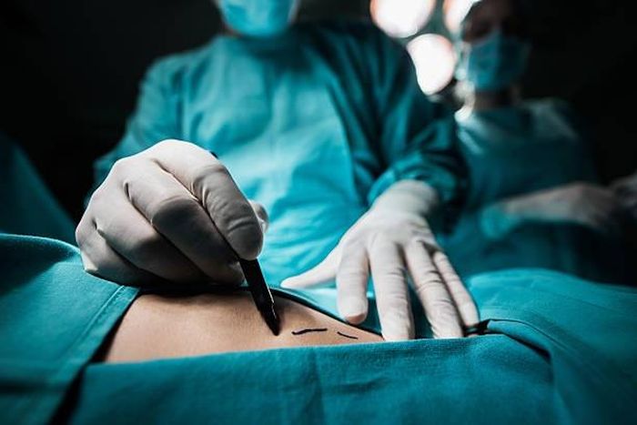 Nhu cầu loại bỏ các vết gấp của da quanh vùng kín đang tăng lên khi quần áo bó trở thành mốt thời trang thịnh hành. Ảnh minh họa: SCMP.