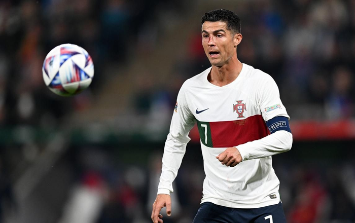 Cú va chạm khiến Ronaldo thi đấu khó khăn. Tuy nhiên, CR7 vẫn để lại dấu ấn trong trận đấu. Ảnh: The Athletic.