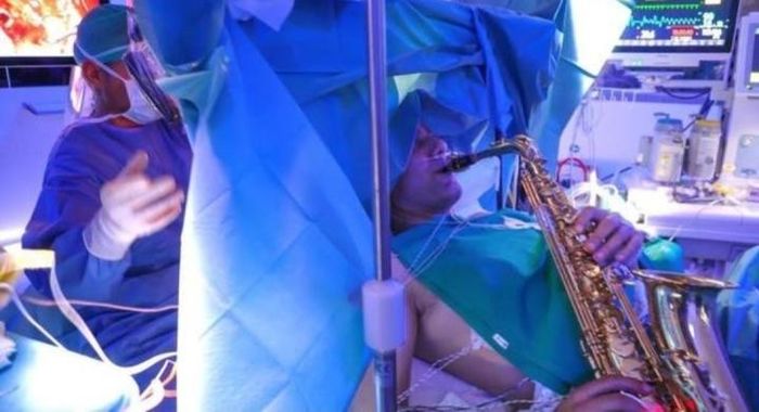 Bệnh nhân chơi kèn saxophone trong ca phẫu thuật não.