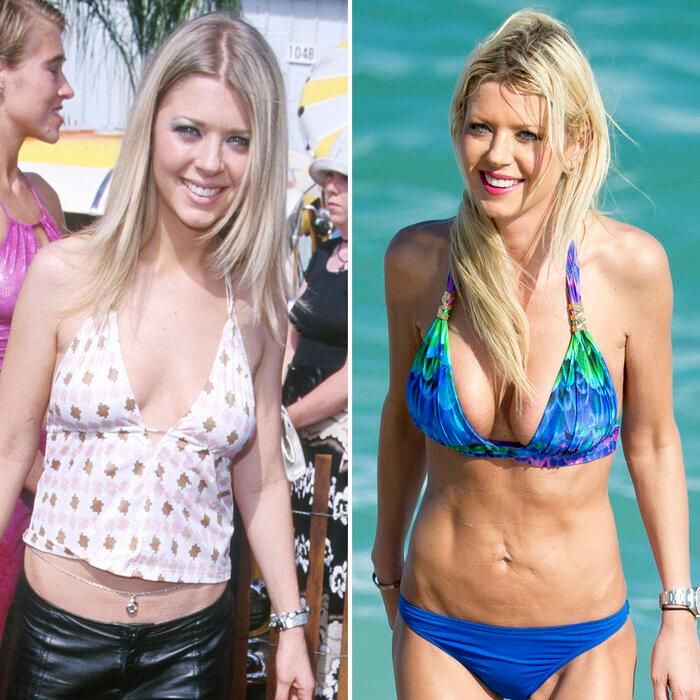 Can thiệp biện pháp thẩm mỹ dành cho vòng 1, Tara Reid nhận về cái kết đắng. Sau nhiều năm, vóc dáng của cô bị ảnh hưởng nặng nề, thậm chí có dấu hiệu bị rạn vùng da bụng. "Vết sưng to ngay cạnh rốn khiến bụng tôi trở nên gồ ghề, không thể mặc bikini'", nữ diễn viên nói. Cô còn tiết lộ bị thoát vị sau thẩm mỹ dẫn đến mất nhiều công việc.