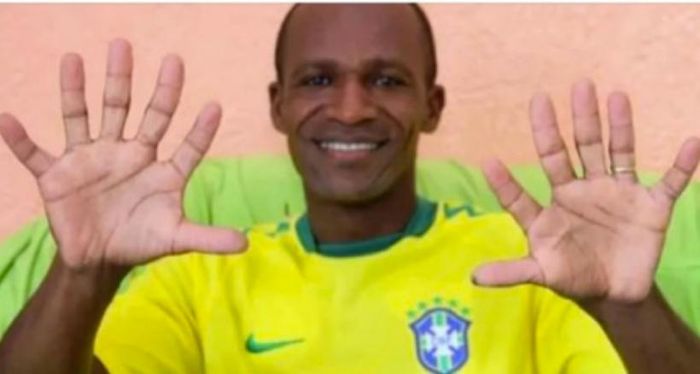 Cổ động viên đặc biệt của Brazil khoe mỗi bàn tay có 6 ngón tay.