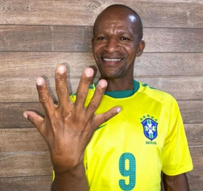 Cổ động viên Josevaldo de Almeida Thome đang hy vọng số lần vô địch World Cup của Brazil sẽ bằng số ngón tay trên một bàn tay của anh.