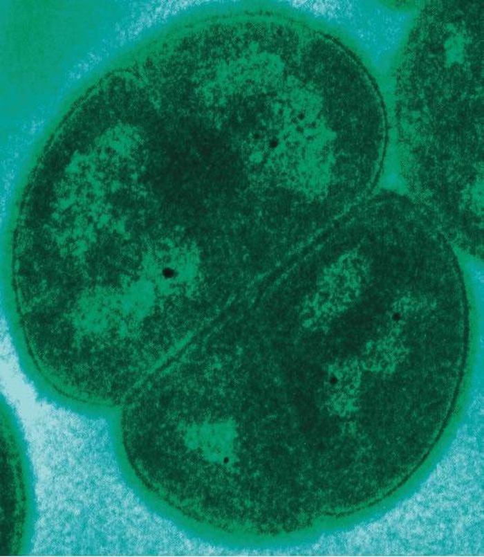 Một nhóm các nhà nghiên cứu Pháp và Croatia do Miroslav Radman thuộc Viện INSERM (Pháp) dẫn đầu đã phát hiện những giai đoạn của sự phục hồi này cho phép con vi khuẩn sống lại sau khi trải qua mức độ bức xạ cực mạnh.