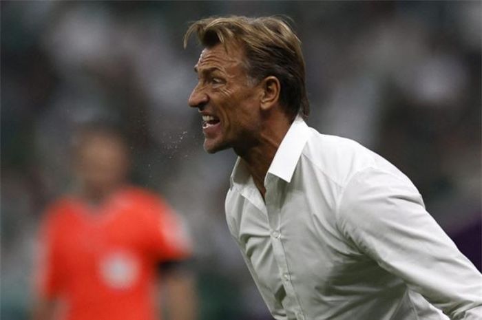 Herve Renard vừa mách nước cho ĐT Pháp cách làm điều đó