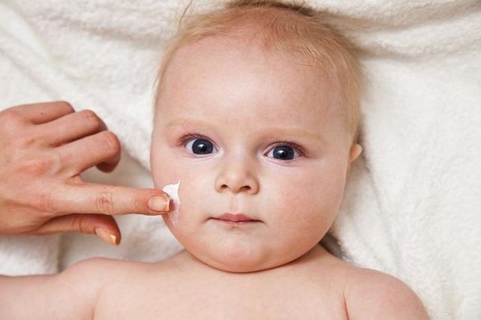 Nếu trẻ sơ sinh mắc bệnh vảy nến cần đưa trẻ tới cơ sở y tế để được thăm khám và đánh giá. Ảnh minh họa.