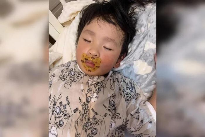  Nhiều phụ huynh tin lời khuyên mạng, mua băng keo về dán miệng trẻ khi ngủ. Ảnh: Straits Times. 