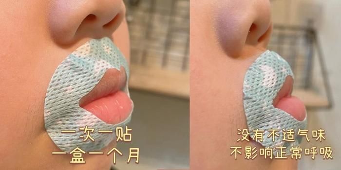  Bác sĩ khuyến cáo không nên dùng băng dán nhưng Li Zhenzhen vẫn nhất quyết không nghe. Ảnh: Xiaohongshu. 