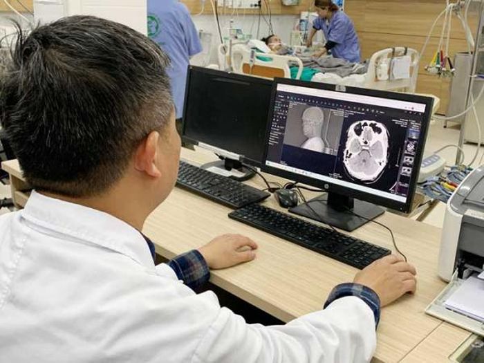 Bác sĩ Nguyễn Trung Nguyên cung cấp hình ảnh bệnh nhân bị nhồi máu não do ngộ độc rượu.