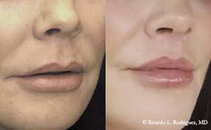 Từ khuôn mặt trên cơ thể con người cũng có thể dự đoán tuổi thọ của người đó. Nếu nhân trung của một người sâu, rõ ràng và dài, có nghĩa là sức khỏe của người đó dồi dào, thể chất cường tráng và tuổi thọ thường sẽ cao hơn. 