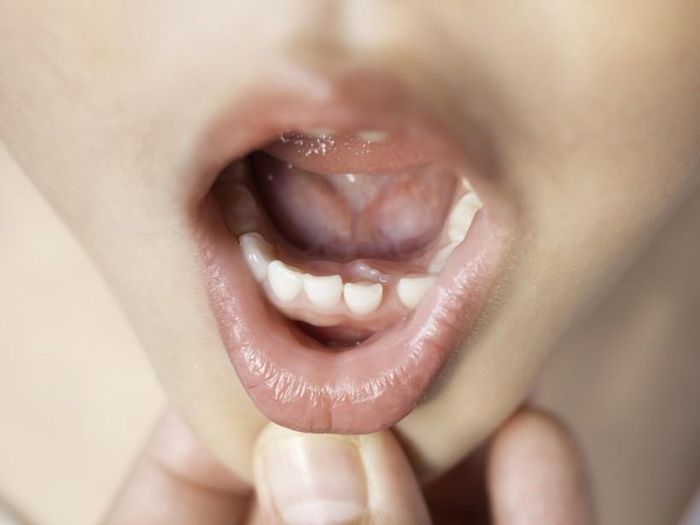  Con bạn nên đi khám nha sĩ sáu tháng một lần. (Ảnh: ITN).