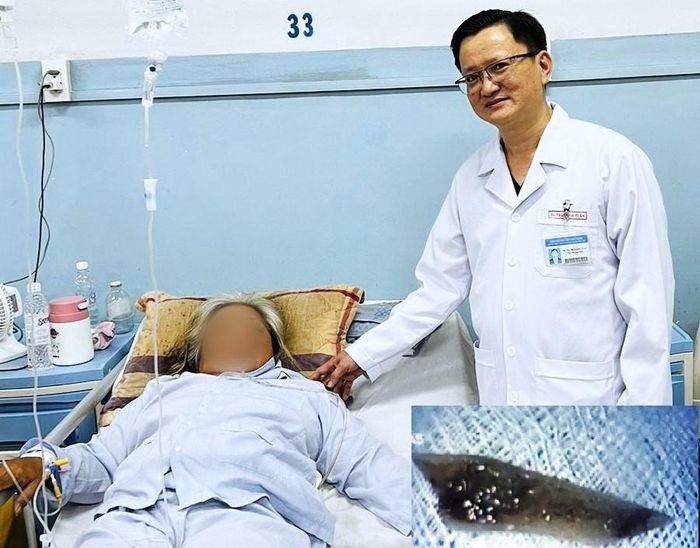 Bệnh nhân hóc dị vật và mảnh xương vịt đâm thủng thành thực quản. Ảnh: BVCC.