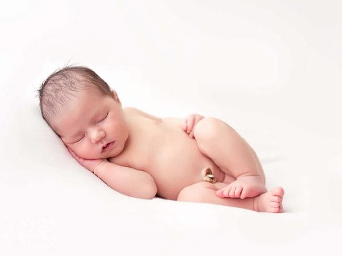 Để phòng tránh polyp rốn ở trẻ sơ sinh cha mẹ nên chú ý đến khâu chăm sóc rốn bé sơ sinh đúng cách. Ảnh minh họa.