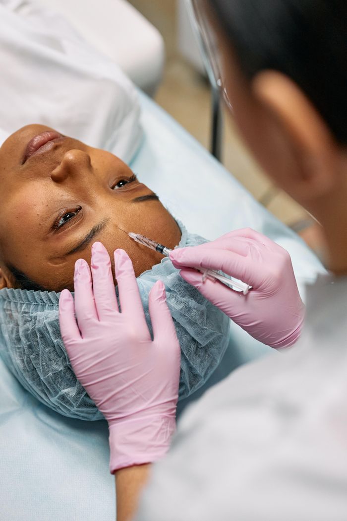  Filler không có tác dụng nâng các mô bị chảy xệ. Ảnh minh họa: Cottonbro Studio/Pexels.