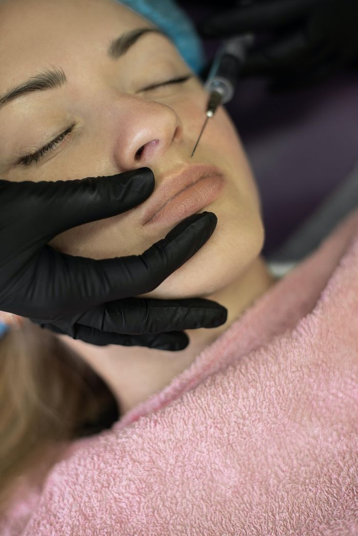  Nhiều người phải đi làm tan filler sau khi lạm dụng liệu pháp này. Ảnh minh họa: Tapanata Ahha/Pexels.