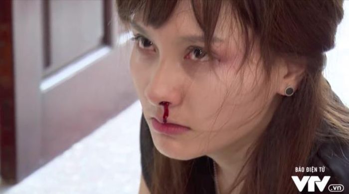 Thậm chí là bị chồng hành hung.