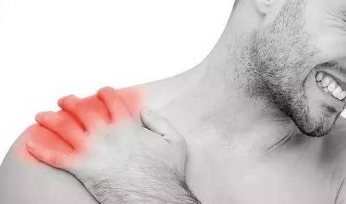 Được biết, khối u Pancoast (u vùng đỉnh phổi) là một loại ung thư phổi phát triển ở phần trên của phổi và có thể lan đến xương sườn, một số đốt sống trong cột sống, dây thần kinh và mạch máu.