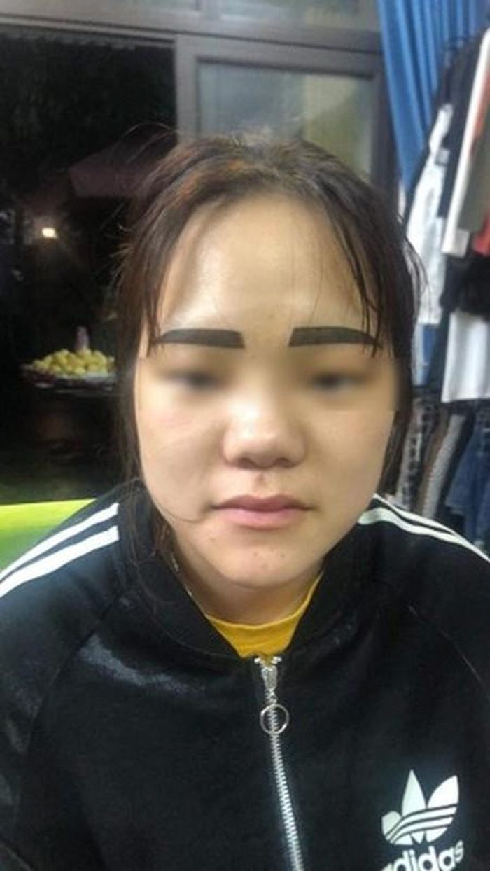 Tệ hơn là điều này còn ảnh hưởng tới công việc của họ khi ai cũng chê “lông mày nhìn sợ”.