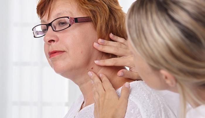 Đốm trắng trên da kèm theo các triệu chứng bất thường như nốt ruồi, vết bớt, mụn nhọt... có thể là triệu chứng của ung thư da (Ảnh: Internet)