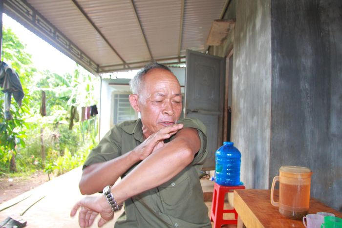 Ông Y Thân Lông Dưng nói về những dấu vết chiến tranh trên cơ thể mình.