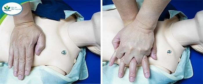 Ép tim ngoài lồng ngực.