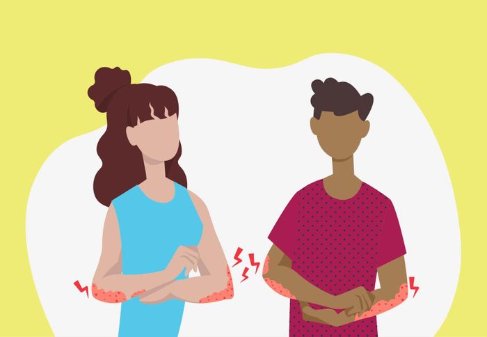 Nhiệt độ và độ ẩm cao vào mùa hè có thể khiến bạn dễ bị phát ban, nổi rôm sảy gây ngứa. Ảnh: Clevelandclinic.