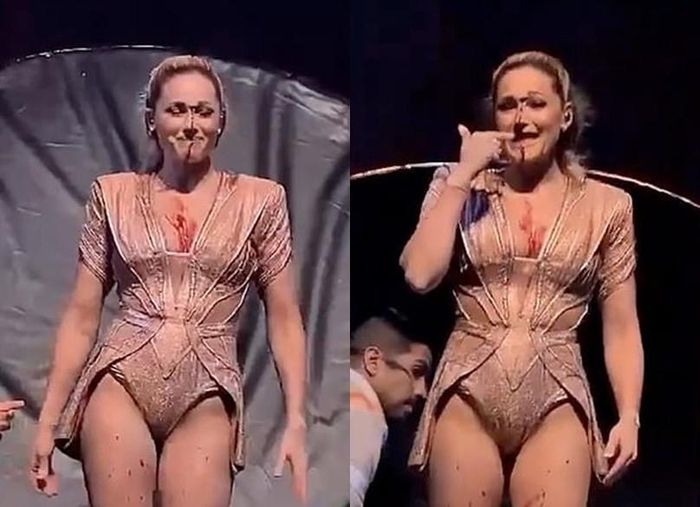 Helene Fischer bình tĩnh hát hết bài nhạc dù gặp tai nạn.