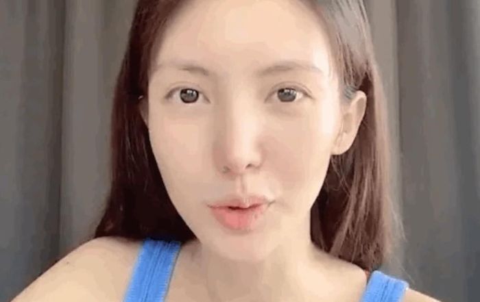 Khuôn miệng bị méo của Kim Thần (ảnh phải) gây bàn tán. Ảnh: Sina.