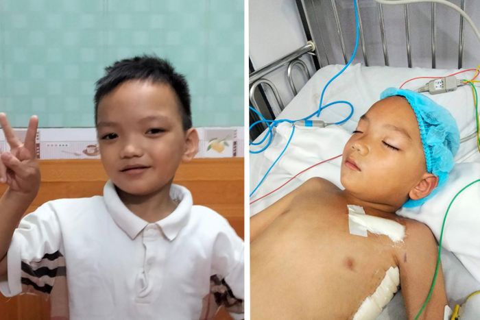 Hình ảnh cháu Phạm Quang Vinh trước và sau khi phẫu thuật
