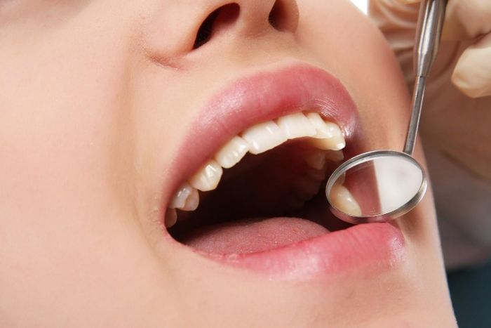 Một trong những nguyên nhân dẫn đến biến chứng sau khi bọc răng sứ là chọn dịch vụ giá rẻ, kém chất lượng.