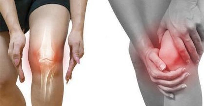 Các trường hợp viêm khớp cấp tính không nên tắm khoáng nóng.