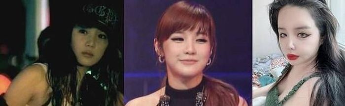 Park Bom thời mới ra mắt và sau khi phẫu thuật thẩm mỹ "quá đà"