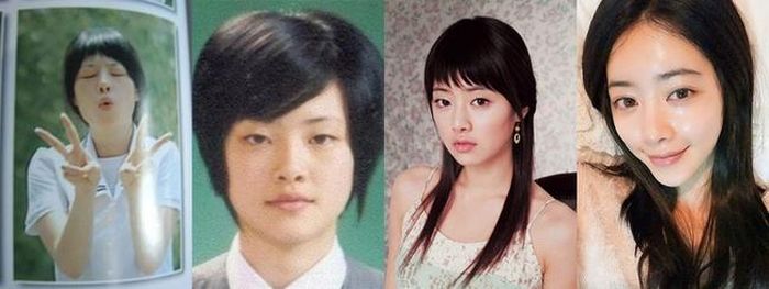 Hình ảnh Hong Soo Ah trước và sau khi phẫu thuật thẩm mỹ