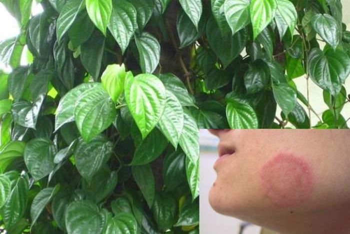 Lá trầu không có tính sát khuẩn cao, tác dụng tốt trị hắc lào.