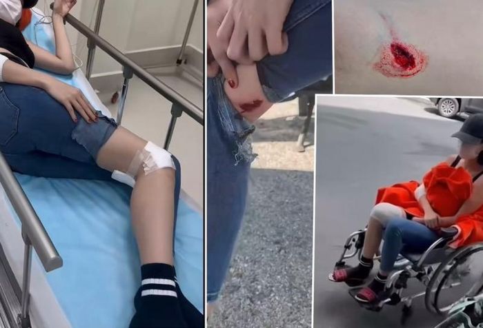 Nick Name Ngọc Trinh với những vết thương do ngã xe