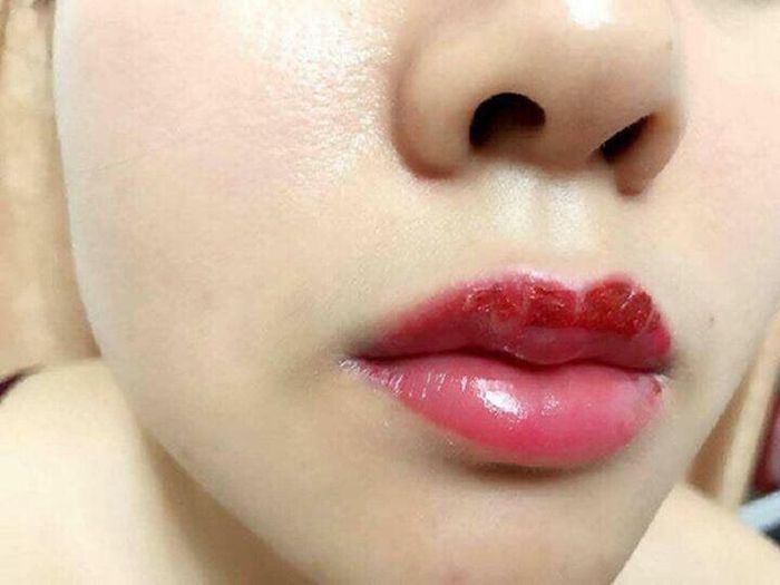Quá trình bong vảy quá sớm không tốt, vì dễ ảnh hưởng đến quá trình lên màu.