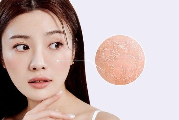 Dưa chuột chống khô da, giúp da trơn nhuận...