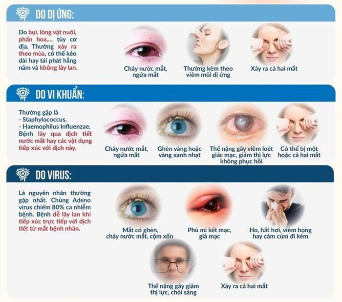 Phân biệt nguyên nhân và triệu chứng của bệnh đau mắt đỏ