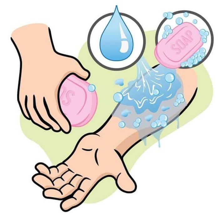 Khi bị chó cắn cần nhanh chóng rửa vết thương bằng xà phòng và nước hoặc bằng các chất có tác dụng diệt khuẩn.