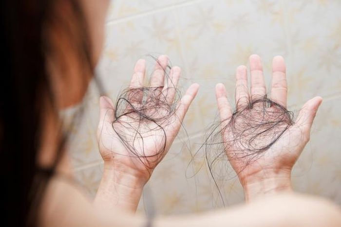 Để chữa rụng tóc, cần tìm ra nguyên nhân gây rụng tóc.
