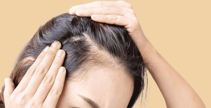 Việc lựa chọn dầu gội, dầu xả phù hơp cũng là một cách để giảm rụng tóc.