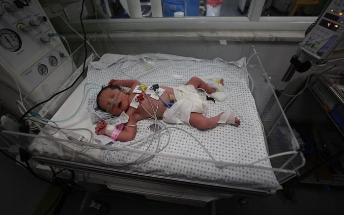 Một em bé được sinh tại Bệnh viện Nasser ở Gaza. Mẹ của bé đã thiệt mạng trong một cuộc không kích của Israel vào ngày 24/10/2023. Ảnh: Getty Images