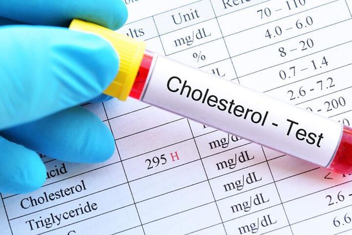 Nếu nồng độ triglyceride cao sẽ làm gia tăng nguy cơ của nhiều vấn đề sức khỏe.